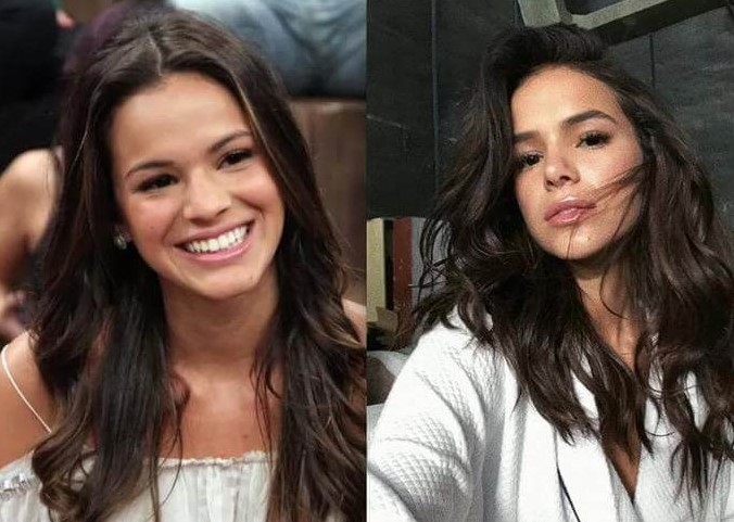 Bruna Marquezine, antes e depois da rinoplastina