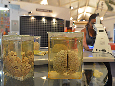 Museu da Patologia mostra o cérebro
