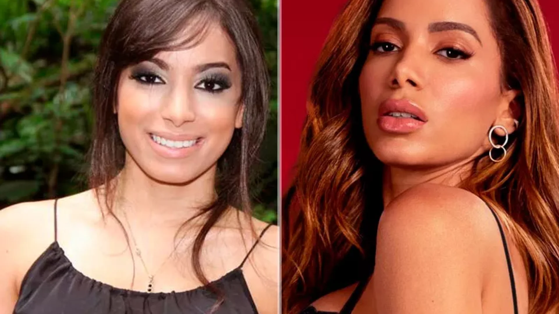 Anitta antes e depois da rinoplastia